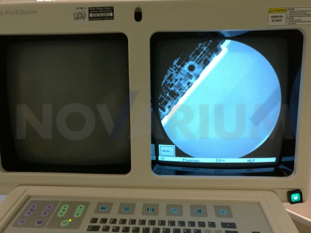 GE 00-901076-03/04 Monitor CRT 16" OEC 9800.jpg