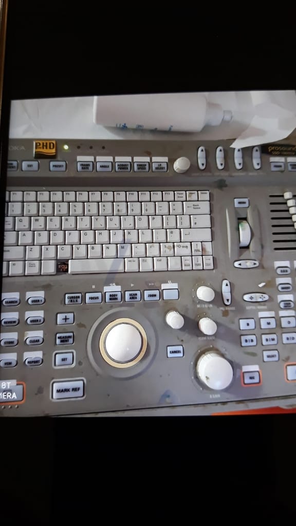 Aloka L-Key-75 - User Interface.jpeg
