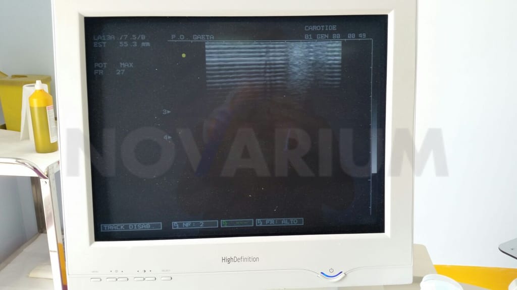 Esaote 9102854030 Monitor 17(1).jpg