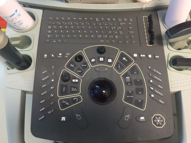 Ultraview 800 User Interface (1).JPG