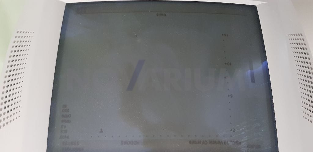 Toshiba BSM31-3080 - Monitor CRT 15" Color CC-15M71-MA.jpg