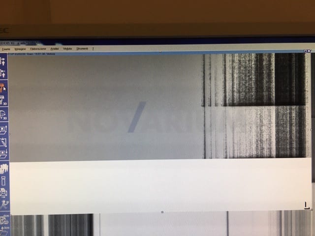 Sirona 5936278 - Detector.jpg